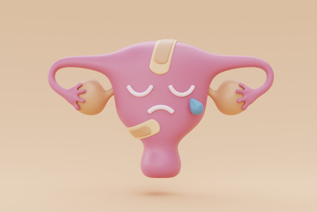 endometriosis